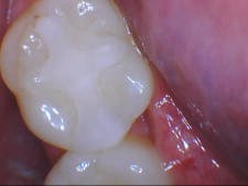 19bcmar28edblog05 19bcmar28edblog05