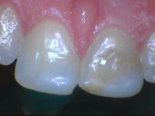 19bcmar28edblog06 19bcmar28edblog06