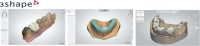Content Dam Diq En Articles 2014 01 3shape Releases Dental System 2014 Leftcolumn Article Thumbnailimage File