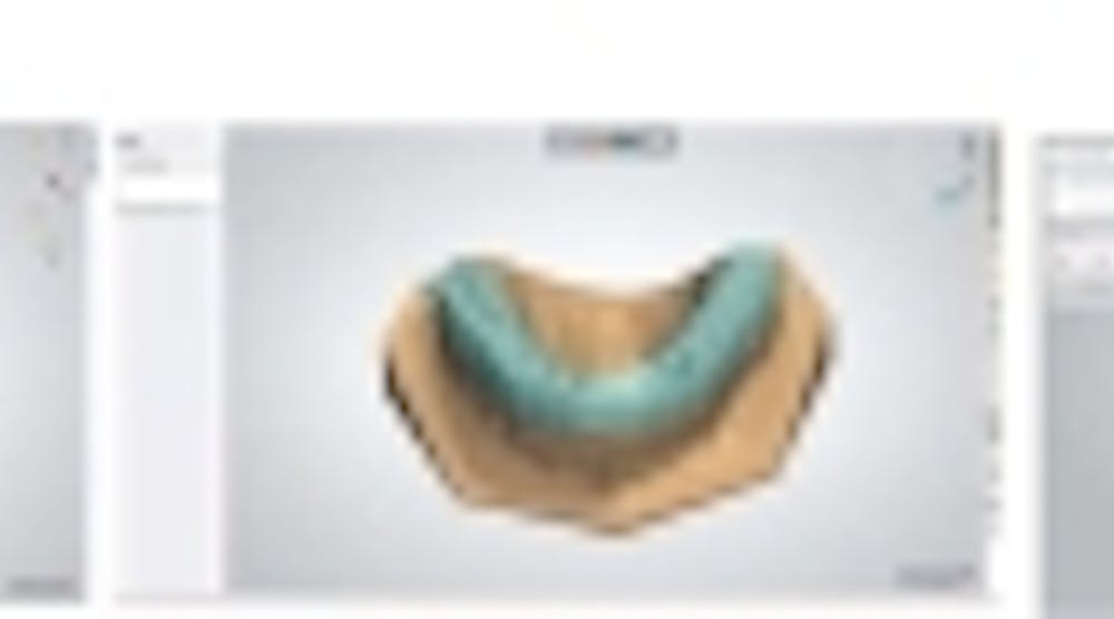 Content Dam Diq En Articles 2014 01 3shape Releases Dental System 2014 Leftcolumn Article Thumbnailimage File