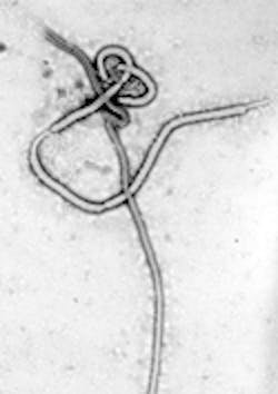 Content Dam Diq En Articles 2014 10 Ada Issues Ebola Advisory For Dentists Dental Practices Leftcolumn Article Thumbnailimage File Content Dam Diq En Articles 2014 10 Ada Issues Ebola Advisory For Dentists Dental Practices Leftcolumn Article Thumbnailimage File
