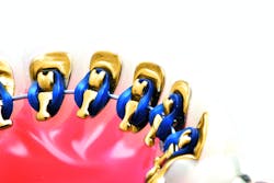 Content Dam Diq En Articles 2015 03 3m Unitek Announces Alastik Lingual Ligatures For The Incognito Appliance System Leftcolumn Article Thumbnailimage File Content Dam Diq En Articles 2015 03 3m Unitek Announces Alastik Lingual Ligatures For The Incognito Appliance System Leftcolumn Article Thumbnailimage File