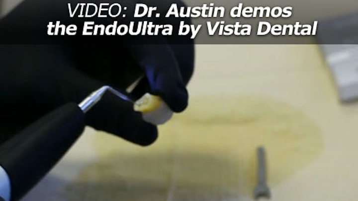 Content Dam Diq En Articles 2015 04 Pearls Enhanced Dr Austin Demos The Endoultra By Vista Dental Video Leftcolumn Article Thumbnailimage File