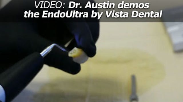 Content Dam Diq En Articles 2015 04 Pearls Enhanced Dr Austin Demos The Endoultra By Vista Dental Video Leftcolumn Article Thumbnailimage File
