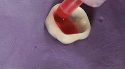 Content Dam Diq En Articles 2016 02 Are You Treating Or Mistreating Your All Ceramic Restorations Leftcolumn Article Thumbnailimage File Content Dam Diq En Articles 2016 02 Are You Treating Or Mistreating Your All Ceramic Restorations Leftcolumn Article Thumbnailimage File