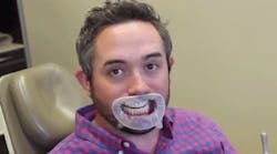 Content Dam Diq En Articles 2016 04 Pearls Enhanced Joshua Austin Dds Fagd Demos The Optragate Lip And Cheek Retractor From Ivoclar Vivadent Inc Video Leftcolumn Article Thumbnailimage File Content Dam Diq En Articles 2016 04 Pearls Enhanced Joshua Austin Dds Fagd Demos The Optragate Lip And Cheek Retractor From Ivoclar Vivadent Inc Video Leftcolumn Article Thumbnailimage File