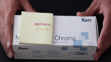 Content Dam Diq En Articles 2016 05 Pearls Enhanced Joshua Austin Dds Fagd Demos Maxcem Elite Chroma Resin Cement From Kerr Video Leftcolumn Article Thumbnailimage File