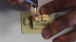 Content Dam Diq En Articles 2016 07 Pearls Enhanced Joshua Austin Dds Fagd Polishes A Class Ii Restoration With 3m S Sof Lex Diamond Polishing System Video Leftcolumn Article Thumbnailimage File Content Dam Diq En Articles 2016 07 Pearls Enhanced Joshua Austin Dds Fagd Polishes A Class Ii Restoration With 3m S Sof Lex Diamond Polishing System Video Leftcolumn Article Thumbnailimage File