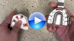 Content Dam Diq En Articles 2017 05 Pearls Enhanced How To Take Open Tray Implant Impressions With Reusable Metal Trays Leftcolumn Article Thumbnailimage File Content Dam Diq En Articles 2017 05 Pearls Enhanced How To Take Open Tray Implant Impressions With Reusable Metal Trays Leftcolumn Article Thumbnailimage File