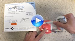 Content Dam Diq En Articles 2017 09 Demo A Bulk Fill Composite That Lets You Keep Your Go To Universal Leftcolumn Article Thumbnailimage File Content Dam Diq En Articles 2017 09 Demo A Bulk Fill Composite That Lets You Keep Your Go To Universal Leftcolumn Article Thumbnailimage File