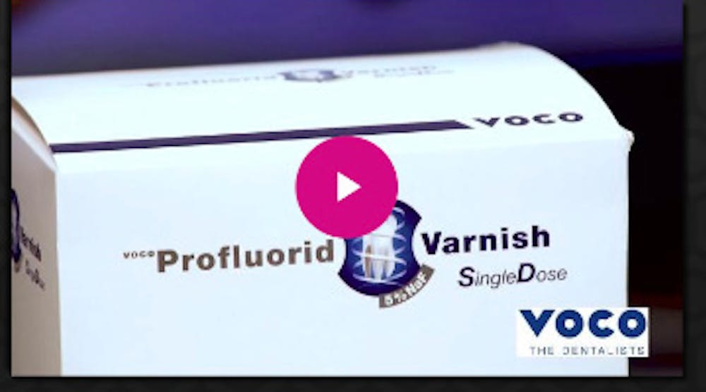 Content Dam Diq En Articles 2017 12 Product Spotlight Profluorid Varnish From Voco Video Leftcolumn Article Thumbnailimage File
