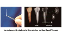 Content Dam Diq En Articles Apex360 2015 10 Nanodiamonds Might Prevent Tooth Loss After Root Canals Leftcolumn Article Thumbnailimage File Content Dam Diq En Articles Apex360 2015 10 Nanodiamonds Might Prevent Tooth Loss After Root Canals Leftcolumn Article Thumbnailimage File