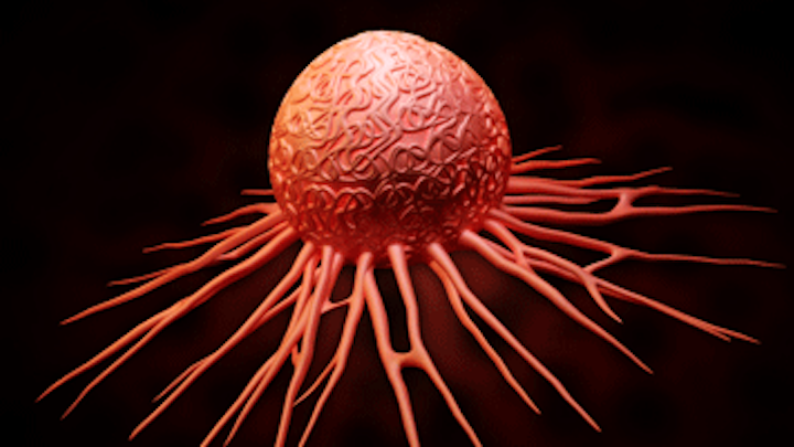 Content Dam Diq En Articles Apex360 2016 05 Oral Bacteria Linked To Pancreatic Cancer Leftcolumn Article Thumbnailimage File