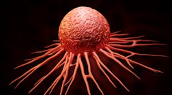 Content Dam Diq En Articles Apex360 2016 05 Oral Bacteria Linked To Pancreatic Cancer Leftcolumn Article Thumbnailimage File Content Dam Diq En Articles Apex360 2016 05 Oral Bacteria Linked To Pancreatic Cancer Leftcolumn Article Thumbnailimage File