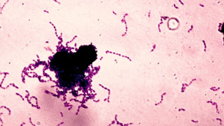 Content Dam Diq En Articles Apex360 2016 11 Researchers Report Promising Plant Made Antimicrobial Peptide Pmamp For Topical Low Cost Disruption Of Oral Biofilm Leftcolumn Article Thumbnailimage File