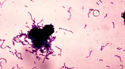 Content Dam Diq En Articles Apex360 2016 11 Researchers Report Promising Plant Made Antimicrobial Peptide Pmamp For Topical Low Cost Disruption Of Oral Biofilm Leftcolumn Article Thumbnailimage File