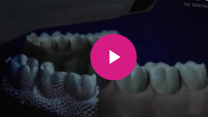 Content Dam Diq En Articles Apex360 2017 03 Ids 2017 Material Mainstay Voco Announces Expansion To Digital Technologies Debuts Subgingival Scanner Video Leftcolumn Article Thumbnailimage File