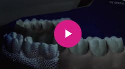 Content Dam Diq En Articles Apex360 2017 03 Ids 2017 Material Mainstay Voco Announces Expansion To Digital Technologies Debuts Subgingival Scanner Video Leftcolumn Article Thumbnailimage File Content Dam Diq En Articles Apex360 2017 03 Ids 2017 Material Mainstay Voco Announces Expansion To Digital Technologies Debuts Subgingival Scanner Video Leftcolumn Article Thumbnailimage File