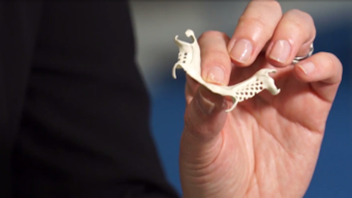 Content Dam Diq En Articles Apex360 2017 03 Ids 2017 Solvay Launches Ultaire Akp A High Performance Polymer Engineered To Replace Metal As The Material Of Choice For Removable Partial Denture Frames Video Leftcolumn Article Thumbnailimage File