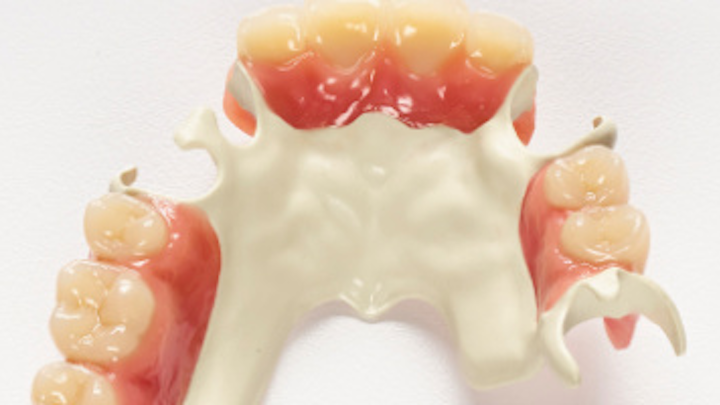 Content Dam Diq En Articles Apex360 2017 10 Solvay Dental 360 Introduces Ultaire Akp A High Performance Polymer For Removable Partial Denture Frames At Ada Meeting Leftcolumn Article Thumbnailimage File
