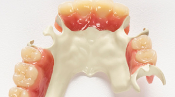 Solvay Dental 360 Introduces Ultaire Akp A High Performance Polymer For Removable Partial Denture Frames At Ada Meeting Dentistryiq