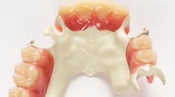 Content Dam Diq En Articles Apex360 2017 10 Solvay Dental 360 Introduces Ultaire Akp A High Performance Polymer For Removable Partial Denture Frames At Ada Meeting Leftcolumn Article Thumbnailimage File
