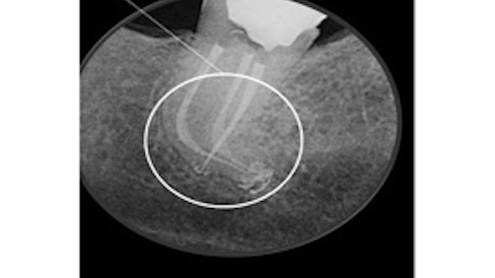 Content Dam Diq En Articles Slideshows 2014 12 Dental Photo Of The Day 06 Leftcolumn Article Thumbnailimage File