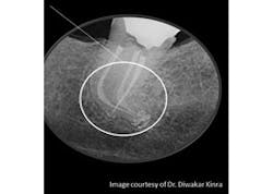 Content Dam Diq En Articles Slideshows 2014 12 Dental Photo Of The Day 06 Leftcolumn Article Thumbnailimage File Content Dam Diq En Articles Slideshows 2014 12 Dental Photo Of The Day 06 Leftcolumn Article Thumbnailimage File
