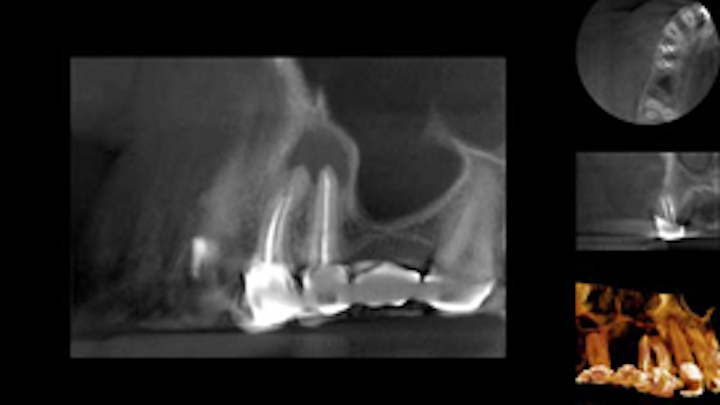 Content Dam Diq En Articles Slideshows 2014 12 Dental Photo Of The Day 07 Leftcolumn Article Thumbnailimage File