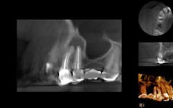 Content Dam Diq En Articles Slideshows 2014 12 Dental Photo Of The Day 07 Leftcolumn Article Thumbnailimage File Content Dam Diq En Articles Slideshows 2014 12 Dental Photo Of The Day 07 Leftcolumn Article Thumbnailimage File