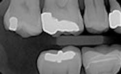 LaserFousWorld Test LaserFousWorld Test