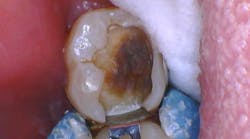 Content Dam Diq Online Articles 2019 03 Knowles Ioc Diqthumb Content Dam Diq Online Articles 2019 03 Knowles Ioc Diqthumb