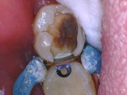 Knowles Ioc 31 Prep Band 600x449 Knowles Ioc 31 Prep Band 600x449