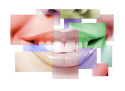 Smile Composite Smile Composite