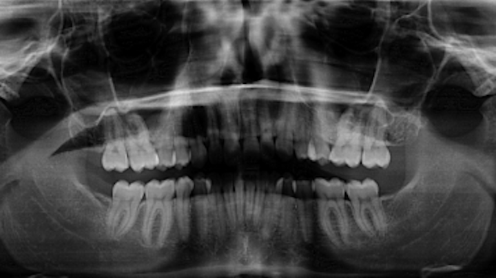If I Don T Let You Take Radiographs You Won T See Me As A Patient Dentistryiq