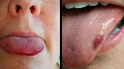 Content Dam Diq Online Articles 2019 04 Seizures Tn Content Dam Diq Online Articles 2019 04 Seizures Tn