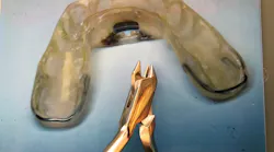 Figure 1: Appliance made by Thomas Schell, DMD