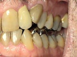 Figure 2: Left lateral view Figure 2: Left lateral view