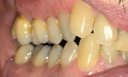 Figure 4: Right lateral view Figure 4: Right lateral view