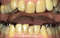 Figure 5: With metal framework installed Figure 5: With metal framework installed