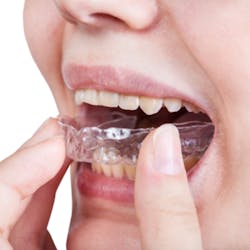 Clear Aligners Clear Aligners
