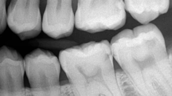 19 Jun27 B Cedblog T