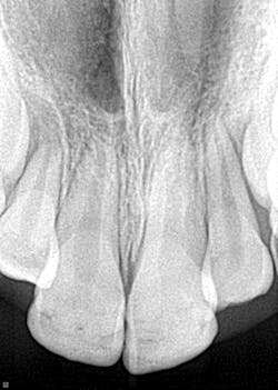 Figure 1: Radiograph, 10-year-old patient