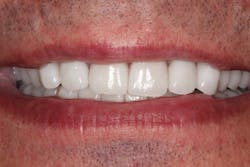 19 Aug22 B Choard02 19 Aug22 B Choard02