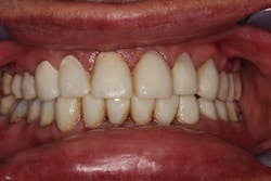 19 Aug22 B Choard04 19 Aug22 B Choard04