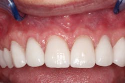 19 Aug22 B Choard08 19 Aug22 B Choard08