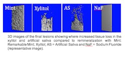 Figure 2: 3-D images of the caries lesion showing increased tooth loss in the xylitol and artificial saliva (AS) groups compared to remineralization with Dr Heff&rsquo;s Remarkable Mints. Courtesy of University of Illinois.