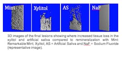 Figure 2: 3-D images of the caries lesion showing increased tooth loss in the xylitol and artificial saliva (AS) groups compared to remineralization with Dr Heff’s Remarkable Mints. Courtesy of University of Illinois. Figure 2: 3-D images of the caries lesion showing increased tooth loss in the xylitol and artificial saliva (AS) groups compared to remineralization with Dr Heff’s Remarkable Mints. Courtesy of University of Illinois.