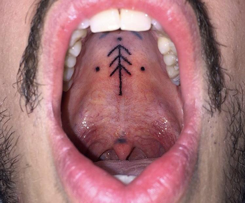 Intraoral and cosmetic tattoos Ink about it  Dentistry IQ
