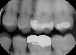 Figure 2: Radiograph from 2019 Figure 2: Radiograph from 2019